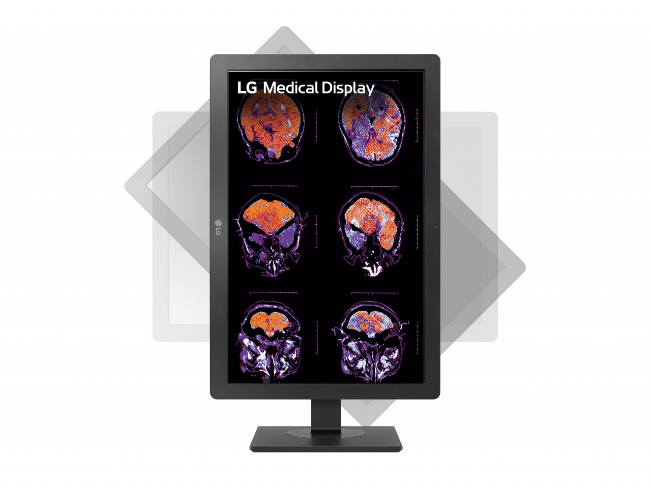 LG전자, 임상에서 진단까지 가능한 의료용 모니터 출시 < 사람·기업 < 기사본문 - 정보통신신문